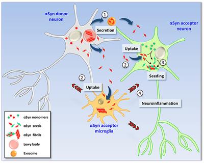 More than a Rumor Spreads in Parkinson's Disease